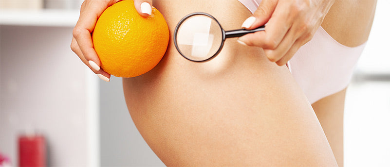 7 tips tegen Cellulits - Hoe sinaasappelhuid wegkrijgen?